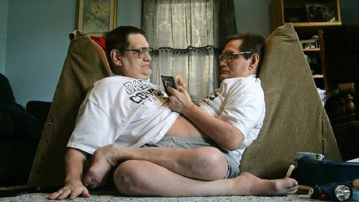 Самые старые сиамские близнецы в мире, ушли из жизни в США